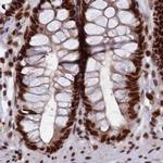 FAM103A1 Antibody in Immunohistochemistry (IHC)