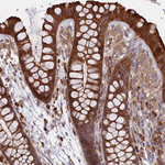 TMEM208 Antibody in Immunohistochemistry (Paraffin) (IHC (P))