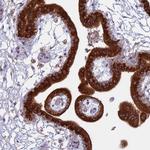 TMEM208 Antibody in Immunohistochemistry (IHC)