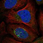 RASGRF1 Polyclonal Antibody