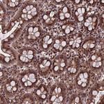 RASGRF1 Antibody in Immunohistochemistry (Paraffin) (IHC (P))