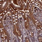 FUK Antibody in Immunohistochemistry (Paraffin) (IHC (P))