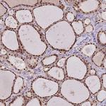 SDS3 Polyclonal Antibody