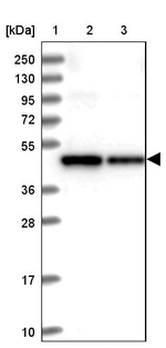 SDS3 Antibody in Western Blot (WB)