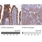 ETFDH Polyclonal Antibody