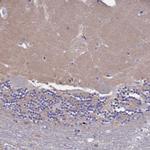 HEATR3 Antibody in Immunohistochemistry (Paraffin) (IHC (P))
