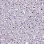 HEATR3 Antibody in Immunohistochemistry (Paraffin) (IHC (P))