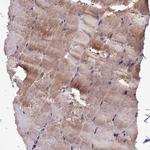 HEATR3 Antibody in Immunohistochemistry (Paraffin) (IHC (P))