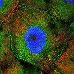 CCDC8 Polyclonal Antibody