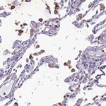 C19orf48 Antibody in Immunohistochemistry (Paraffin) (IHC (P))