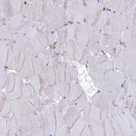 C19orf48 Antibody in Immunohistochemistry (Paraffin) (IHC (P))