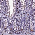 C19orf48 Antibody in Immunohistochemistry (Paraffin) (IHC (P))