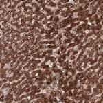 C19orf66 Antibody in Immunohistochemistry (IHC)