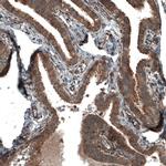 C19orf66 Antibody in Immunohistochemistry (IHC)