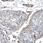 C19orf66 Antibody in Immunohistochemistry (IHC)