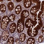 DCTN5 Polyclonal Antibody