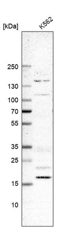 DCTN5 Antibody in Western Blot (WB)