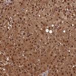 PAPL Polyclonal Antibody