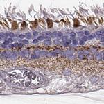 RDH13 Antibody in Immunohistochemistry (IHC)