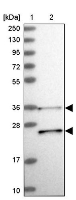 RDH13 Antibody in Western Blot (WB)
