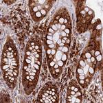 SSC5D Antibody in Immunohistochemistry (Paraffin) (IHC (P))