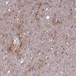 P2X7 Polyclonal Antibody