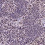 CCL23 Polyclonal Antibody