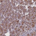 CCL23 Antibody in Immunohistochemistry (Paraffin) (IHC (P))