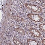 CCL23 Antibody in Immunohistochemistry (Paraffin) (IHC (P))