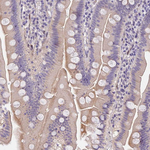 MIDN Antibody in Immunohistochemistry (Paraffin) (IHC (P))