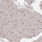 MIDN Antibody in Immunohistochemistry (Paraffin) (IHC (P))