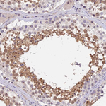 MIDN Antibody in Immunohistochemistry (Paraffin) (IHC (P))