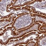HEATR5B Antibody in Immunohistochemistry (Paraffin) (IHC (P))