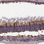 IQCB1 Antibody in Immunohistochemistry (IHC)