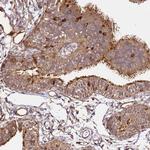 KATNAL2 Antibody in Immunohistochemistry (Paraffin) (IHC (P))