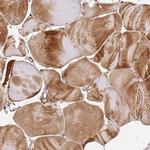 KATNAL2 Antibody in Immunohistochemistry (Paraffin) (IHC (P))