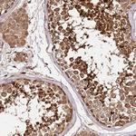 KATNAL2 Antibody in Immunohistochemistry (Paraffin) (IHC (P))