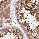 KATNAL2 Antibody in Immunohistochemistry (IHC)