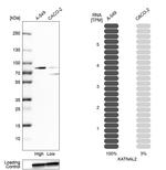 KATNAL2 Antibody in Western Blot (WB)