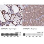 CHMP2A Polyclonal Antibody