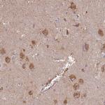 STX16 Antibody in Immunohistochemistry (IHC)