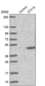 STX16 Antibody in Western Blot (WB)