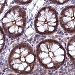 TMC5 Antibody in Immunohistochemistry (IHC)