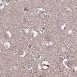 TMC5 Antibody in Immunohistochemistry (IHC)