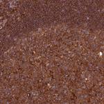 MYO9B Antibody in Immunohistochemistry (Paraffin) (IHC (P))