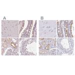 TREH Polyclonal Antibody