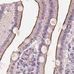 TREH Antibody in Immunohistochemistry (IHC)