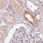 TREH Antibody in Immunohistochemistry (IHC)
