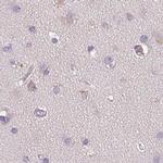 TREH Antibody in Immunohistochemistry (IHC)