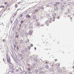 TREH Antibody in Immunohistochemistry (IHC)